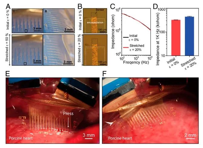 斯坦福大學鮑哲南團隊：柔性電子新突破！細胞級分辨率心電監(jiān)測，守護人類健康