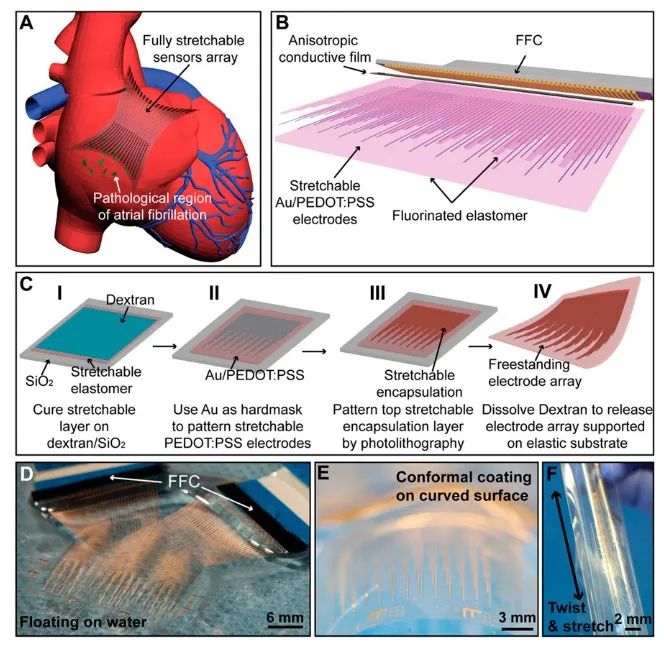 斯坦福大學鮑哲南團隊：柔性電子新突破！細胞級分辨率心電監(jiān)測，守護人類健康