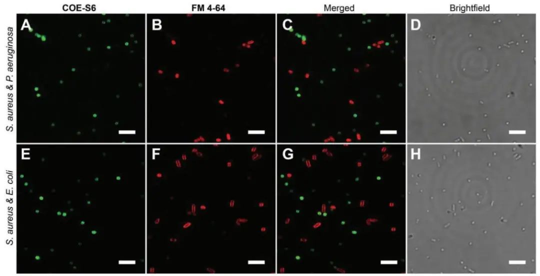 新加坡國(guó)立大學(xué)《AFM?》：肉眼可見(jiàn)！共軛低聚電解質(zhì)助力革蘭氏細(xì)菌的區(qū)分